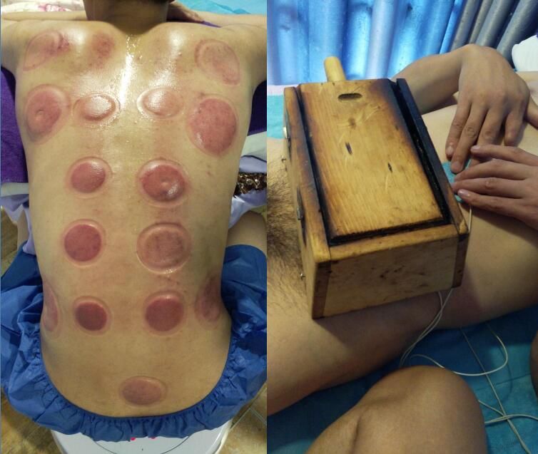 按摩养生